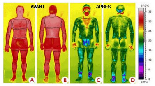 La cryothérapie pour soulager les douleurs et pour récupérer plus vite après le sport chute de température de la peau de la tête aux pieds